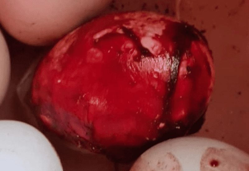 bloody egg